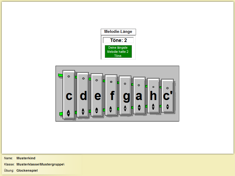 Glockenspiel_A Glockenspiel_A